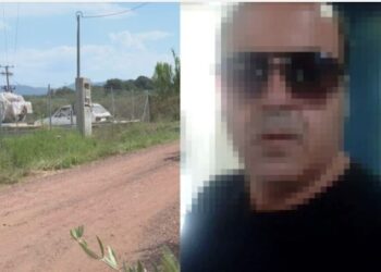 Μεσσήνη: “Με είχε φεσώσει, θόλωσα” – Τα πρώτα λόγια του 50χρονου που επιτέθηκε με καυστικό υγρό στην πρώην σύζυγό του