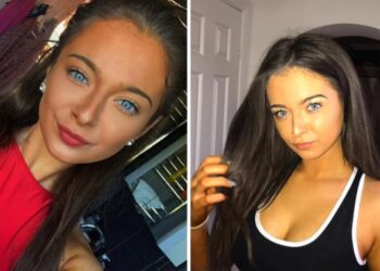 Κοιμόταν για ώρες και νόμιζε ότι έφταιγε το hangover – Η διάγνωση την έκανε να χάσει «την γη κάτω από τα πόδια της»