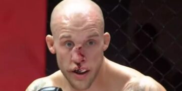 MMA: Του διέλυσε τη μύτη με μία γονατιά[video]