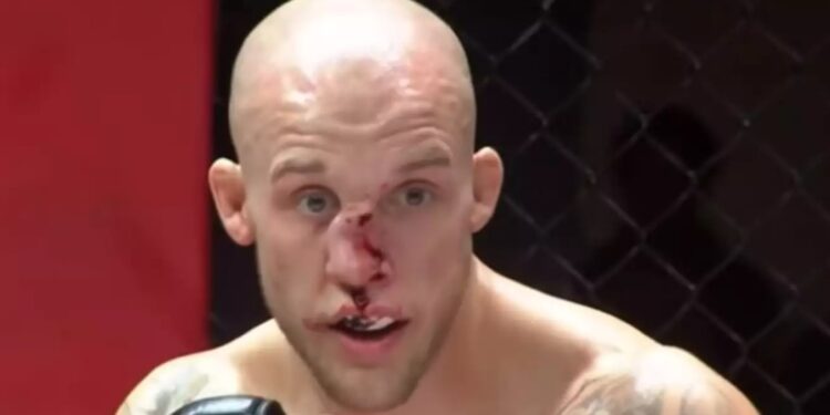 MMA: Του διέλυσε τη μύτη με μία γονατιά[video]