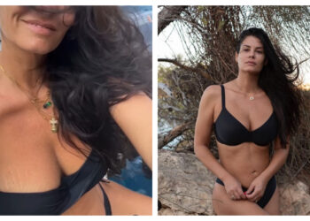 Χωρίς φίλτρα και.. κόμπλεξ: Η Μαρία Κορινθίου δείχνει τις ραγάδες στο στήθoς της και περνά το δικό της μήνυμα[video]