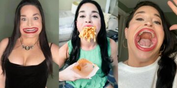 Μπήκε στο βιβλίο Γκίνες: 31χρονη έχει το μεγαλύτερο στόμα στον κόσμο και γίνεται virαl στο διαδίκτυο