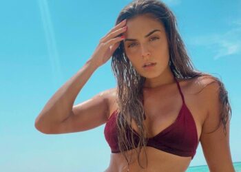 Βρισηίδα Ανδριώτου: Το πρόβλημα υγείας που αντιμετωπίζει μετά το Survivor - Τι λέει η ίδια