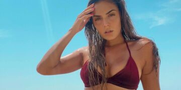 Βρισηίδα Ανδριώτου: Το πρόβλημα υγείας που αντιμετωπίζει μετά το Survivor - Τι λέει η ίδια