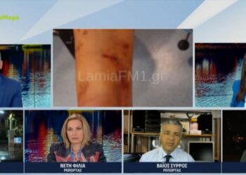 Λαμία: Σκύλος κατασπάραξε 35χρονη – Υπέστη κάταγμα το δεξί χέρι της