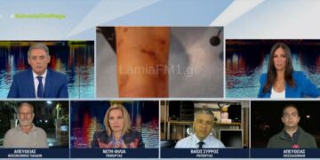 Λαμία: Σκύλος κατασπάραξε 35χρονη – Υπέστη κάταγμα το δεξί χέρι της