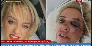 Alldaynews.gr Άγρια επίθεση αδέσποτων σε νεαρή γυναίκα(Εικόνες Σοκ)