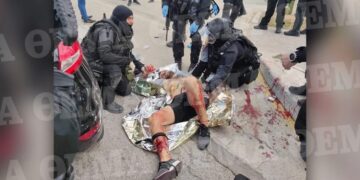 Alldaynews.gr Πολυτεχνειούπολη Ζωγράφου: Ο Αλβανός κακοποιός δέχεται τις πρώτες βοήθειες από τους άνδρες των ΕΚΑΜ