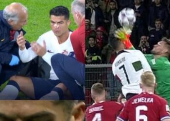 Alldaynews.gr Σοβαρός τραυματισμός του Κριστιάνο Ρονάλντο από τον Βατσλίκ: Βγήκε αιμόφυρτος από το γήπεδο (vids)