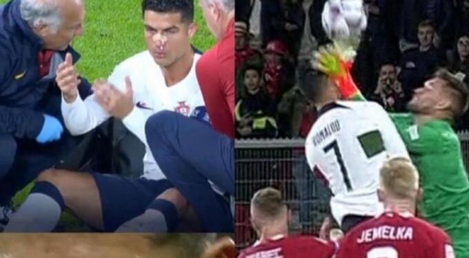 Σοβαρός τραυματισμός του Κριστιάνο Ρονάλντο από τον Βατσλίκ: Βγήκε αιμόφυρτος από το γήπεδο (vids)