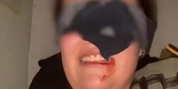 Με σάλτσα για αίμα: Παρίστανε το θύμα απαγωγής σε βίντεο για να αποσπάσει λύτρα από τη μητέρα της (video)