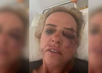 «Δεν είπα ποτέ ότι με δάγκωσαν τα σκυλιά» διευκρινίζει τώρα η 45χρονη (video)