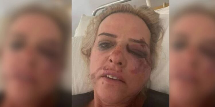 Alldaynews.gr «Δεν είπα ποτέ ότι με δάγκωσαν τα σκυλιά» διευκρινίζει τώρα η 45χρονη (video)