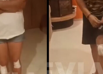 Alldaynews.gr Καταγγελία από μητέρα και γιο: Τους έδειραν γιατί έκαναν παρατήρηση να μην… χτυπούν τα αδέσποτα σκυλιά! (video)