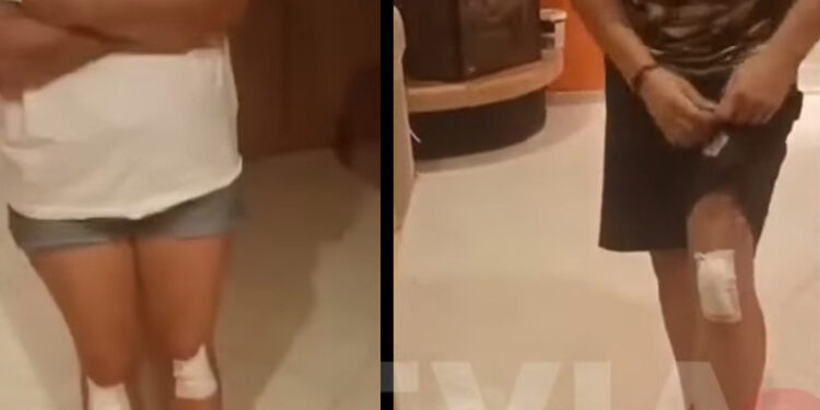 Alldaynews.gr Καταγγελία από μητέρα και γιο: Τους έδειραν γιατί έκαναν παρατήρηση να μην… χτυπούν τα αδέσποτα σκυλιά! (video)