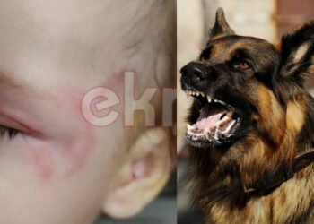 Alldaynews.gr Συγκλονίζει ο πατέρας του βρέφους για την επίθεση από λυκόσκυλο: «Δάγκωνε με μανία το παιδί μου» – «Αντί να ζητήσει συγνώμη…»