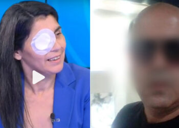 «Ούρλιαζα, καιγόμουν – Ήταν σαν να μου είχαν βάλει φωτιά», λέει η Χριστίνα για την επίθεση με οξύ από τον πρώην σύζυγο