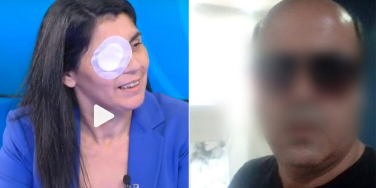 Alldaynews.gr «Ούρλιαζα, καιγόμουν – Ήταν σαν να μου είχαν βάλει φωτιά», λέει η Χριστίνα για την επίθεση με οξύ από τον πρώην σύζυγο