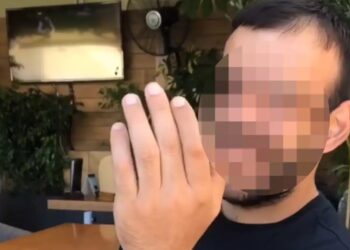 Επίθεση με καυστικό υγρό: Αυτός είναι ο άτυχος 36χρονος – «Δεν αποκλείεται να χάσει το μάτι του»