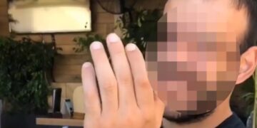 Alldaynews.gr Επίθεση με καυστικό υγρό: Αυτός είναι ο άτυχος 36χρονος – «Δεν αποκλείεται να χάσει το μάτι του»