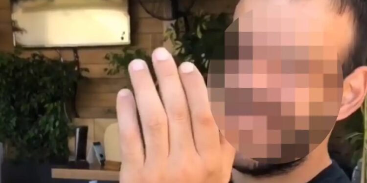 Alldaynews.gr Επίθεση με καυστικό υγρό: Αυτός είναι ο άτυχος 36χρονος – «Δεν αποκλείεται να χάσει το μάτι του»