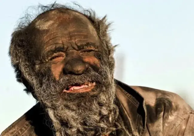 Πέθανε σε ηλικία 94 ετών ο «πιο βρόμικος άνθρωπος στον κόσμο» - Είχε να πλυθεί πάνω από 50 χρόνια