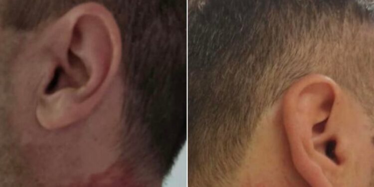 Alldaynews.gr Θεσσαλονίκη: Σοκάρουν οι εικόνες με τα τραύματα των αστυνομικών που δέχτηκαν επίθεση από αλλοδαπό