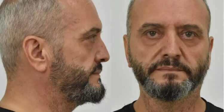 Alldaynews.gr Κολωνός: Αυτός είναι ο 53χρονος που βίαζε και εξέδιδε τη 12χρονη