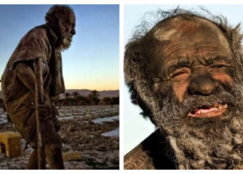 Πέθανε σε ηλικία 94 ετών ο «πιο βρόμικος άνθρωπος στον κόσμο» – Είχε να πλυθεί πάνω από 50 χρόνια