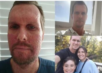 Άνδρας που διαγνώστηκε με καρκίνο 4ου σταδίου αποκαλύπτει το πρώτο προειδοποιητικό σημάδι