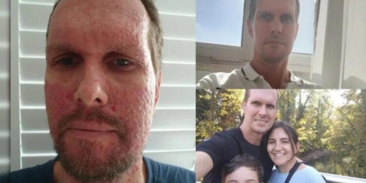 Alldaynews.gr Άνδρας που διαγνώστηκε με καρκίνο 4ου σταδίου αποκαλύπτει το πρώτο προειδοποιητικό σημάδι