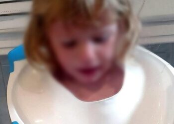 2χρονη σφήνωσε με το κεφάλι σε… παιδικό κάθισμα τουαλέτας!