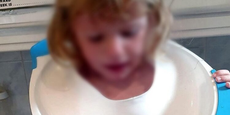 Alldaynews.gr 2χρονη σφήνωσε με το κεφάλι σε… παιδικό κάθισμα τουαλέτας!