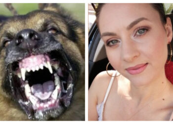 Καλαμάτα: Κατασπάραξαν τα σκυλιά 34χρονη μητέρα και δυο μήνες μετά έχει μείνει άνεργη και οι πληγές παραμένουν ανοιχτές