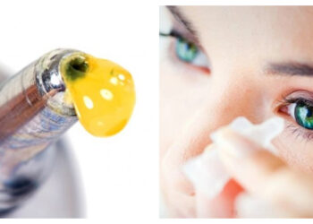 Νεαρή κατέληξε στα επείγοντα αφού μπέρδεψε το κολλύριο της με… σούπερ κόλλα