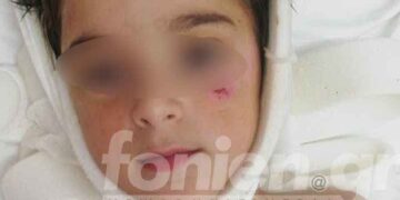 Χαμογελά ξανά ο μικρός Γιώργος που τον χτύπησε 10 φορές το κριάρι