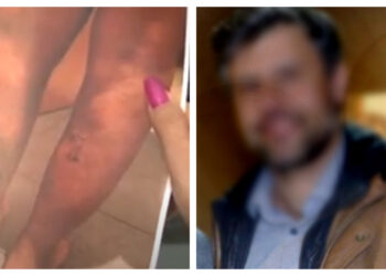 Θεσσαλονίκη: «Με συρραπτικό έκλεινε τις πληγές», λέει γυναίκα για τον γιατρό που δέχτηκε επίθεση