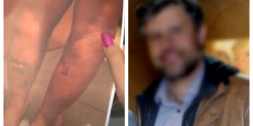 Alldaynews.gr Θεσσαλονίκη: «Με συρραπτικό έκλεινε τις πληγές», λέει γυναίκα για τον γιατρό που δέχτηκε επίθεση