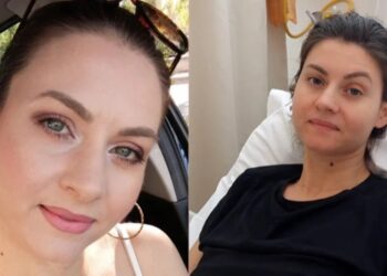 Σε άσχημη κατάσταση η 34χρονη Αγάπη: Έμεινε χωρίς δουλειά και με ανοιχτές πληγές 2 μήνες μετά την άγρια επίθεση