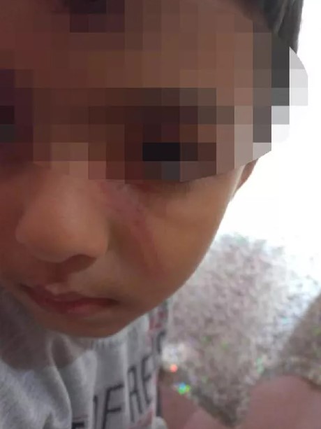 Φρικτά βασανιστήρια από γονείς στα παιδιά τους: Τα έκαιγαν με αναπτήρα και έκλειναν το στόμα τους με ταινία