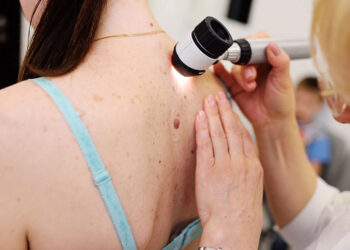 Ελπίδες δίνει εμβόλιο των Moderna και Merck κατά του καρκίνου του δέρματος – Μειώνει κατά 44% τον κίνδυνο υποτροπής ή θανάτου