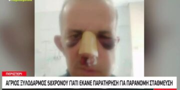 Alldaynews.gr Άγριος ξυλοδαρμός στο Περιστέρι: Του ζήτησε να μετακινήσει το αυτοκίνητό του κι εκείνος τον σακάτεψε (video)