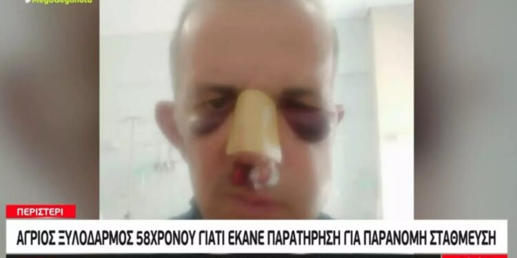 Alldaynews.gr Άγριος ξυλοδαρμός στο Περιστέρι: Του ζήτησε να μετακινήσει το αυτοκίνητό του κι εκείνος τον σακάτεψε (video)