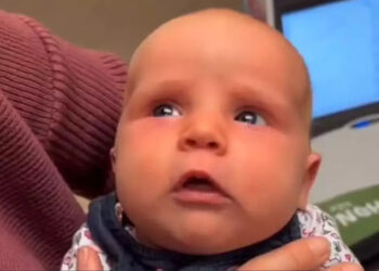 Η μικρή που άκουσε για πρώτη φορά – Το βίντεο που έκανε το ίντερνετ να δακρύσει