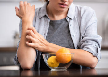 Μεγάλη Προσοχή! Μια Απλή Φαγούρα μπορεί να είναι Καρκίνος του Δέρματος