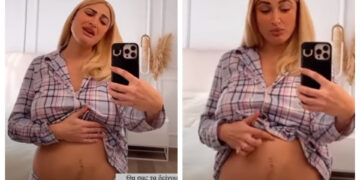 «Έτσι είναι η κοιλιά μου, πονάω πολύ»: Η Τούνη δείχνει το σώμα της 4 μέρες μετά τη γέννα και στέλνει ένα σπουδαίο μήνυμα