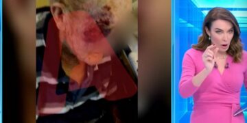 Κορυδαλλός: Εικόνες σοκ από το γηροκομείο – Έπαιζαν μποξ χτυπώντας ηλικιωμένους[Σοκαριστικές Εικόνες]