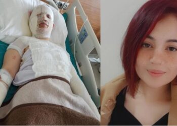 Τουρκία: Είπε στην πρώην του να την φιλοξενήσει μετά τον σεισμό και της έριξε καυτό νερό όταν κοιμόταν