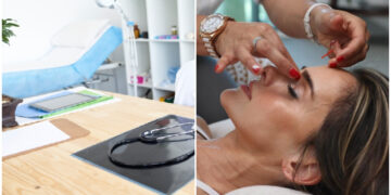 Καταγγελίες για παράνομα μπότοξ στην Πάτρα – Δεκάδες γυναίκες έχουν παραμορφωθεί