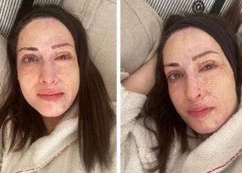 Ιωάννα Παλιοσπύρου: «Ακόμα παλεύω να αποδεχτώ τον νέο μου εαυτό»-Φωτογραφίες χωρίς ίχνος make up